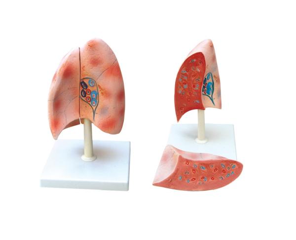 Model of Human Lungs